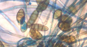 Jak rozpoznat a léčit nosematózu u včel?